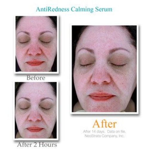 Exuviance Anti Redness Calming Serum, 1.0 Ounce
