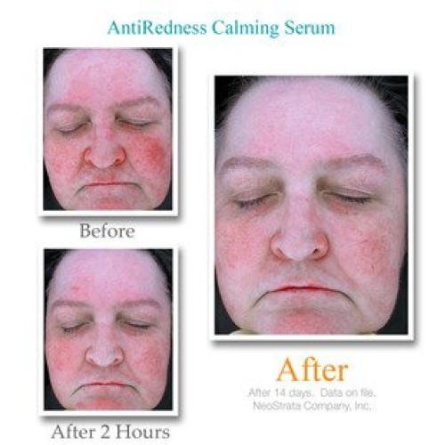 Exuviance Anti Redness Calming Serum, 1.0 Ounce