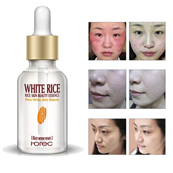 FeiFei66 Natural Revitalizing Essence White Rice Skin Nourishing ...