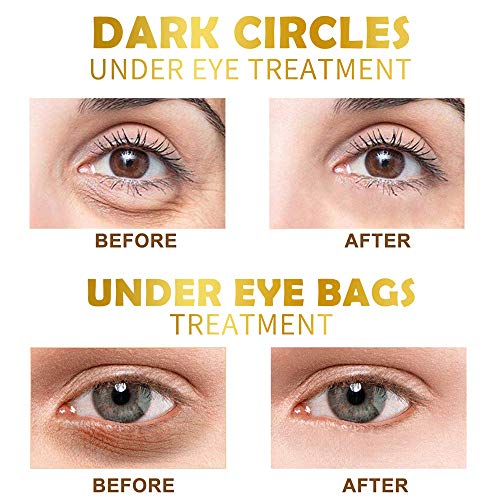 Under Eye Patches, 24K Gold Eye Mask, 60PCS Eye Gel Pads With Col...