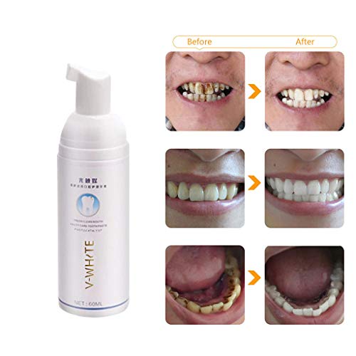 Fullfun Tooth Mousse Foam Toothpaste Remove Bad Breath Tooth Stai...