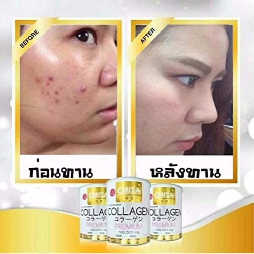 Chita Collagen 180,000 mg. 100% Collagen Pure1Whitening Skin Smoo...