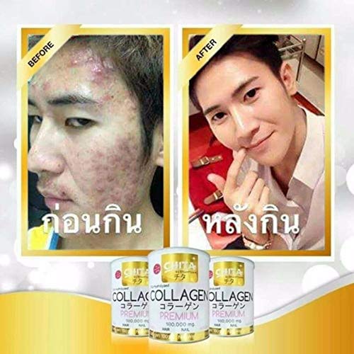 Chita Collagen 180,000 mg. 100% Collagen Pure1Whitening Skin Smoo...