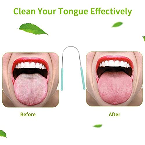 1Pcs Steel Tongue Scraper Clean Reusable Tongue Brush Remove Food...