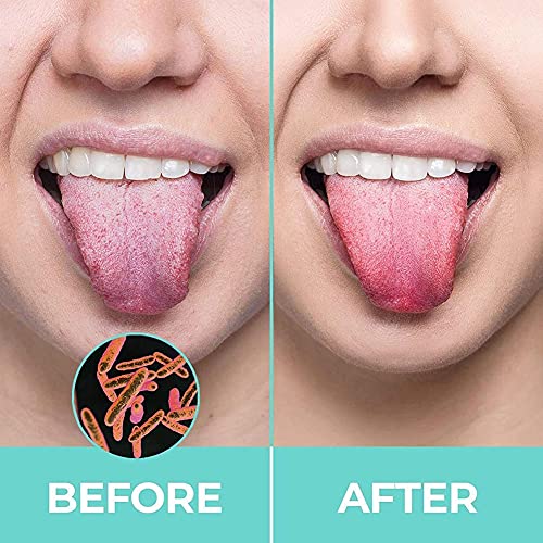 1Pcs Steel Tongue Scraper Clean Reusable Tongue Brush Remove Food...