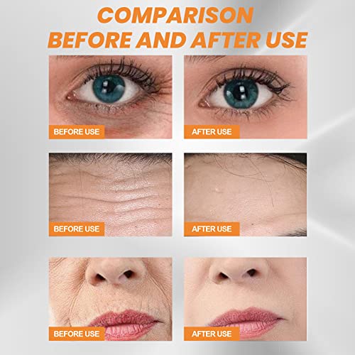 5 Pairs DERMANCE Korea Highprime Collagen Soluble Film, Anti Agin...