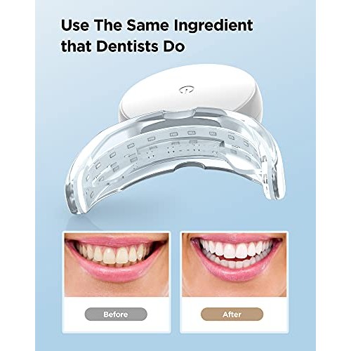 Teeth Whitening Strips with Light, 28 Dentist-Level White Strips ...