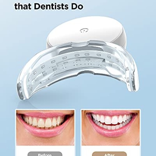 Teeth Whitening Strips with Light, 28 Dentist-Level White Strips ...