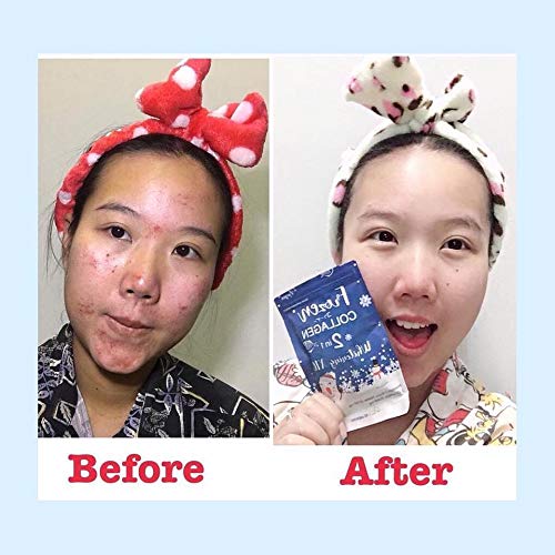 Gluta Frozen Collagen 2 In 1 whitening ×10 Nourish the skin to cl...