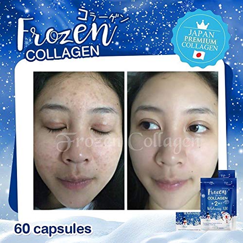 Gluta Frozen Collagen 2 In 1 whitening ×10 Nourish the skin to cl...