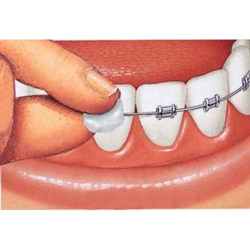 GUM Orthodontic Wax, Original + Vitamin E, Bulk Pack 24