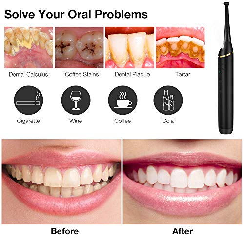 Electric Dental Calculus Remover with LED, HailiCare Tooth Tartar...