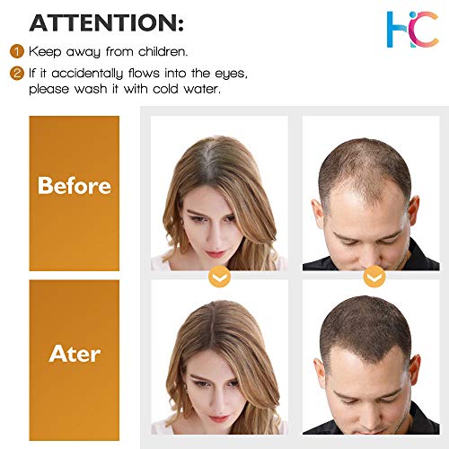 Hair Growth Serum, Ginger Hair Growth Oil, Anti Hair Loss Serum, ...