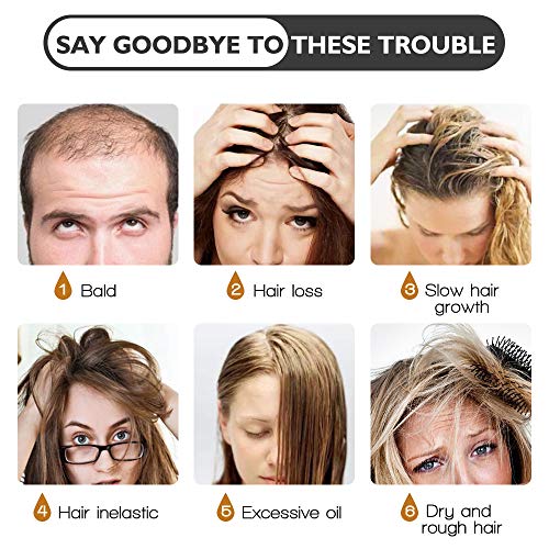 Hair Growth Serum, Ginger Hair Growth Oil, Anti Hair Loss Serum, ...