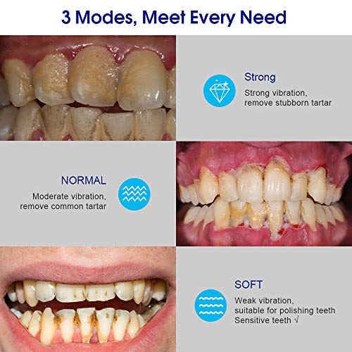Teeth Calculus Remover, Electric Tartar Scraper Plaque Remover St...