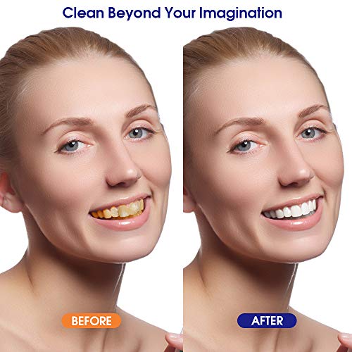 Teeth Calculus Remover, Electric Tartar Scraper Plaque Remover St...