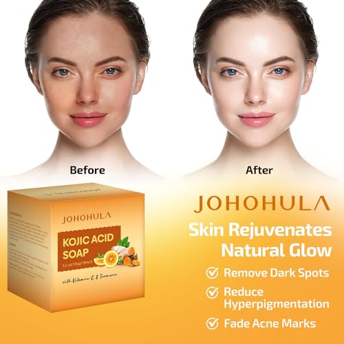 Johohula Kojic Acid Dark Spot Remover Soap Bars with Vitamin C, R...