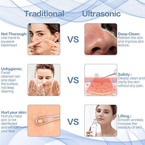 Ultrasonic Skin Scrubber Face Spatula, JOMARTO Blackhead Remover ...