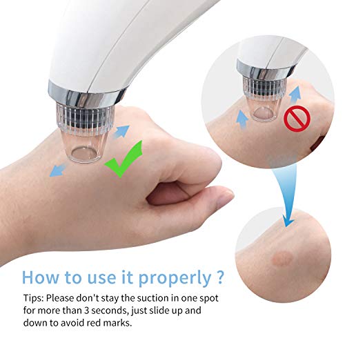 Blackhead Remover Pore Vacuum - Kahe Facial Pore Cleaner Electric...