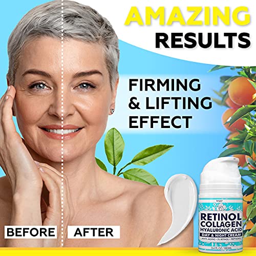 Retinol Cream for Face - Helps Reduce Wrinkles, Fine Lines, Dryne...