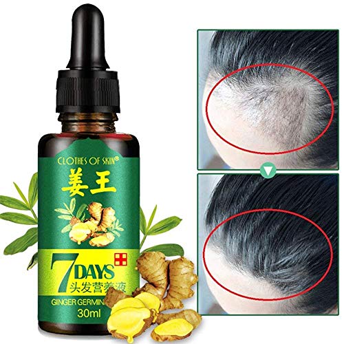 Ginger Germinal Oil Hair Growth Serum 2PCS + Bonus Hair Comb | Gi...