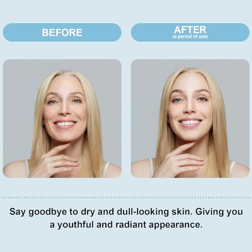 Lisara Moisturizer Face Cream, Hyaluronic Acid Moisturizer For Fa...
