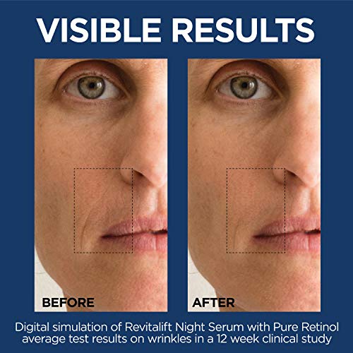 LOreal Paris Retinol Serum for Face, Night Serum 0.3% Pure Retin...