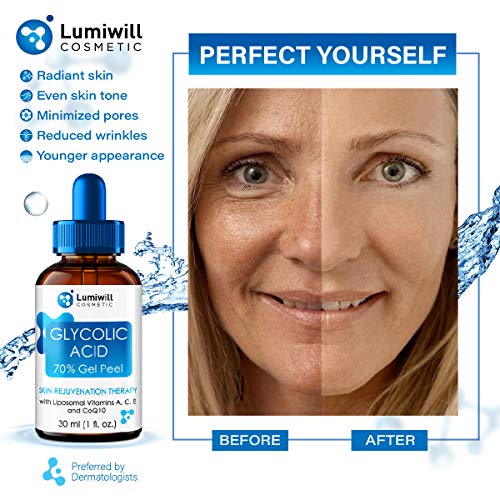 Glycolic Acid Peel 70% - Made in USA - Natural Glycolic Acid for ...