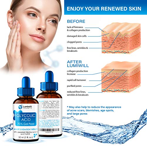 Glycolic Acid Peel 70% - Made in USA - Natural Glycolic Acid for ...