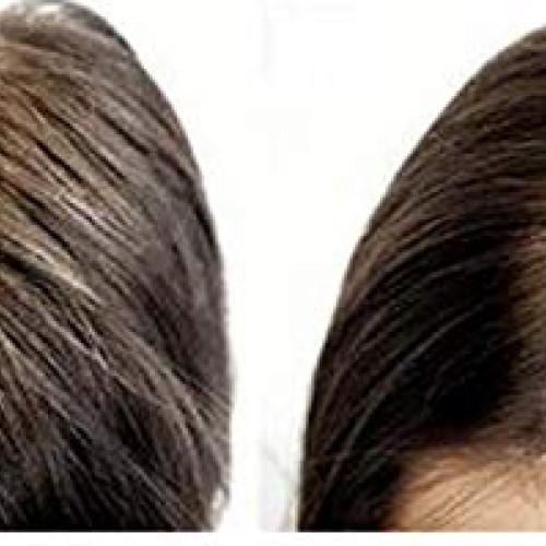 Hair Activating Serum 120 ML M2BEAUTE Hair Regrowth Treatment for...