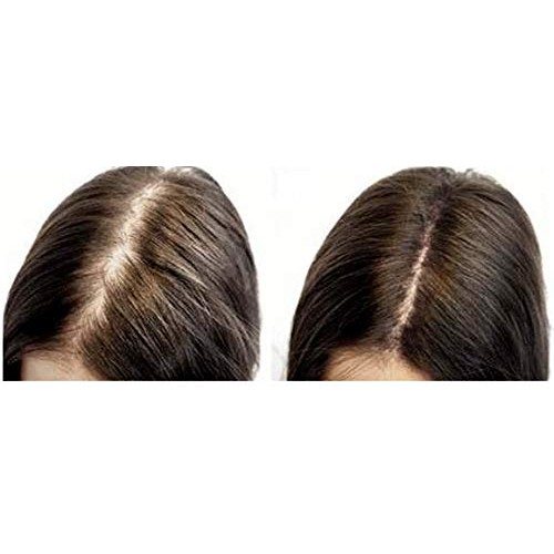 Hair Activating Serum 120 ML M2BEAUTE Hair Regrowth Treatment for...