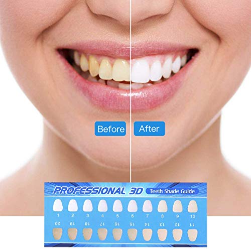 MayBeau Teeth Whitening Gel Kit With Reusable Led Accelerator Lig...