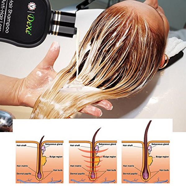 DEXE Anti Hair Loss Shampoo Growth Treatment