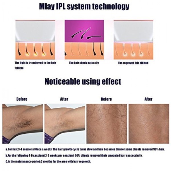 3 Lampes Hair Removal System, IPL Permanent Face Body Hair Remova...