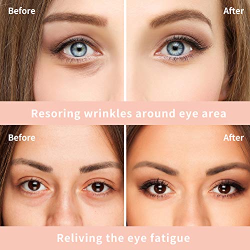 2 PCS Eye Cream for Dark Circles and Puffiness Under Eye Bags Fin...