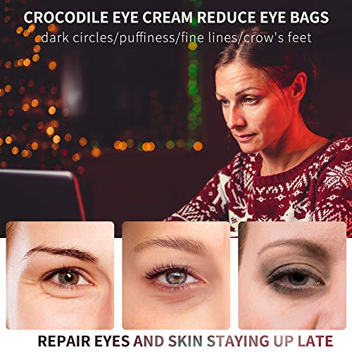 2 PCS Eye Cream for Dark Circles and Puffiness Under Eye Bags Fin...