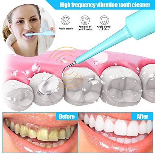 Electric Sonic Dental Calculus Plaque Remover Tool - Dental Scale...