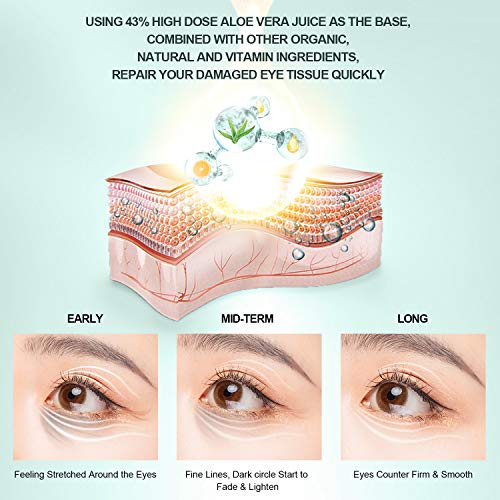 Eye Cream - Under Eye Treatment for Anti Aging, Dark Circles, Eye...