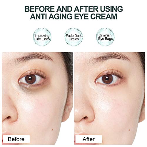 Eye Cream - Under Eye Treatment for Anti Aging, Dark Circles, Eye...