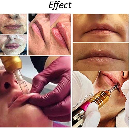 NSWD Hyaluron Pen +5 Ampoule Head High Pressure Acid Skin Ca...
