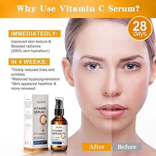 Vitamin C Serum for Face 2oz 31% Vitamin C Facial Moisturizer Ser...