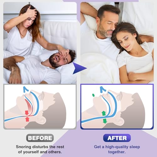 Anti Snoring Devices,Snore Stopper with Adjustable Magnet, Silico...