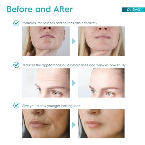 OLISMO Rapid Anti Aging Serum, Face Lift Cream, Advanced Retinol ...
