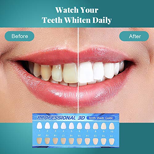 OriHea Teeth Whitening Kit with LED Light, Dental Whitener, 8 Syr...