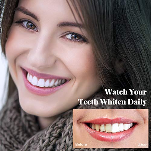 OriHea Teeth Whitening Kit with LED Light, Dental Whitener, 8 Syr...