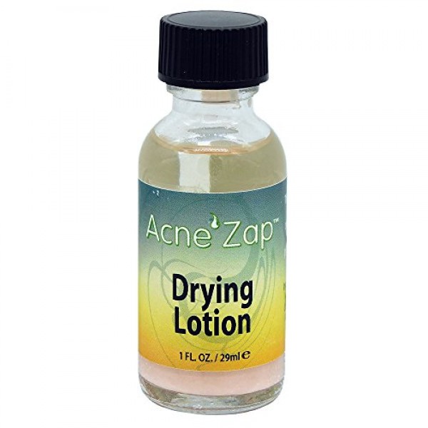 Acne Zap Drying Lotion, Spot Treatment, Dries Acne, Pimples & Ble...