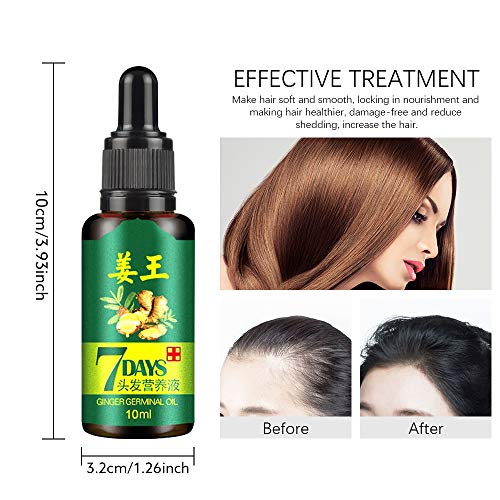 Ownest 3 Packs Hair Growth Ginger Essence Oil,Hair Loss and Hair ...