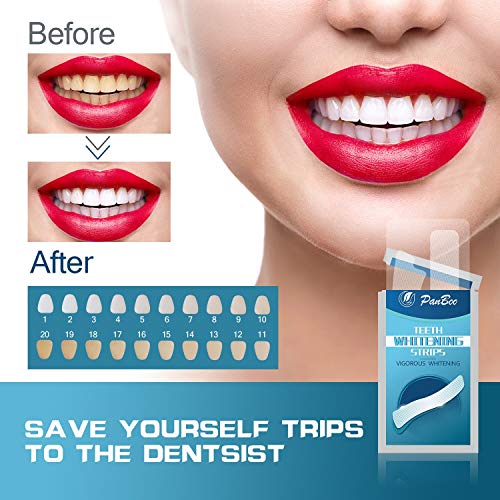 Pdoo Teeth Whitening Strips with 56 Strips Remove Years of Stains...