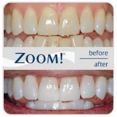 Philips Zoom 14% Teeth Whitening Gel 3 syringes Mint Flavor