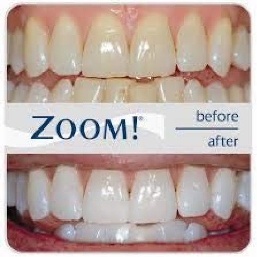 Philips Zoom 14% Teeth Whitening Gel 3 syringes Mint Flavor